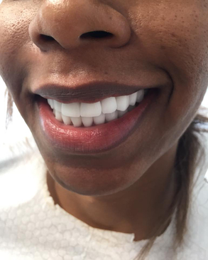 Slider image (4) Dr. Erdal Kumkumoglu - Praktijk Istanbul